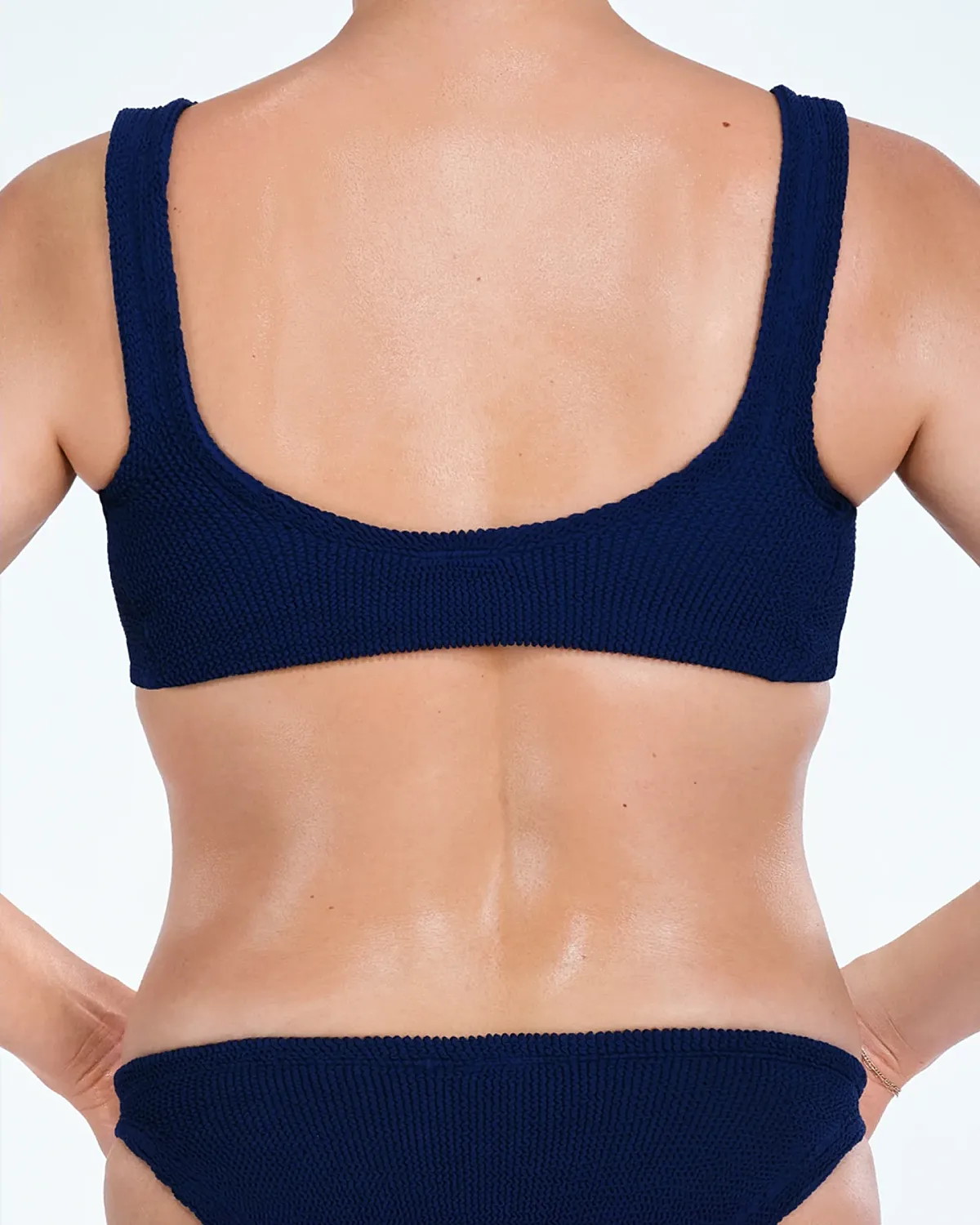 Coolsculpting Before & After