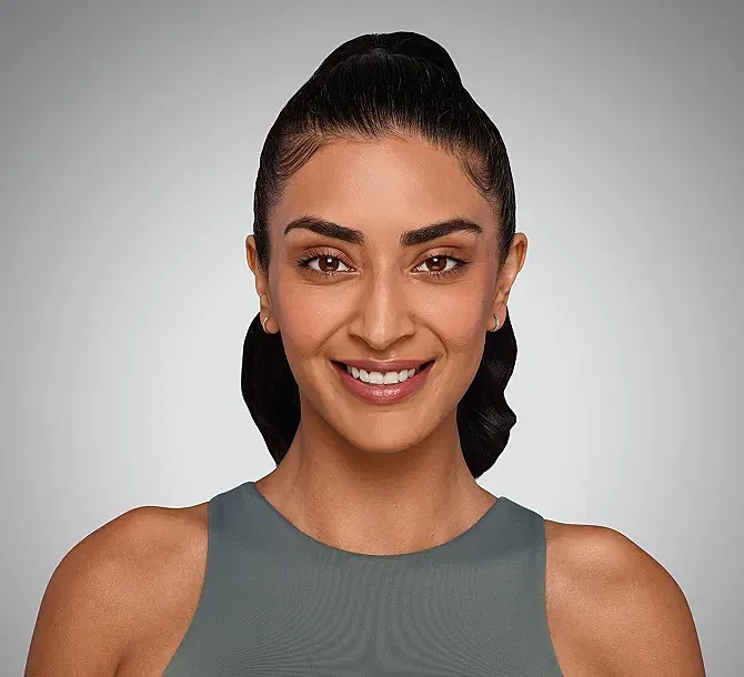 Juvederm Before & After