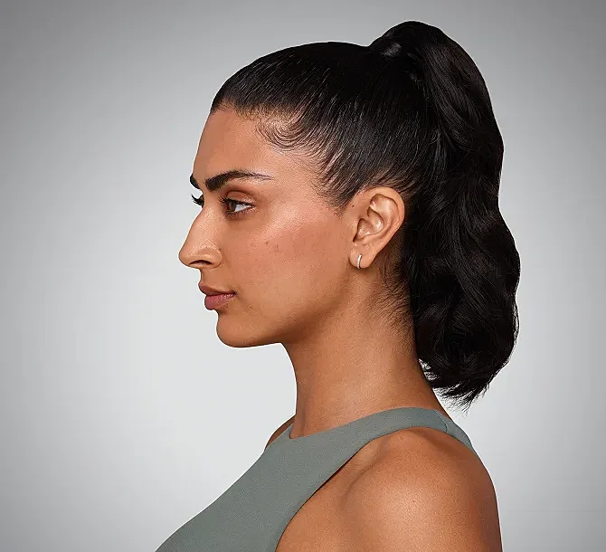 Juvederm Before & After