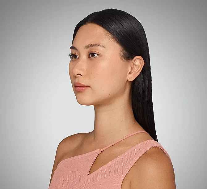 Juvederm Before & After